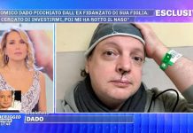 Dado a Pomeriggio 5, l’intervista al comico di Zelig “picchiato dall’ex di sua figlia” | video Foto Dado Pomeriggio 5