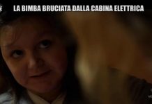 Le Iene, Palmieri: “Vicky, la bambina bruciata dalla cabina elettrica” | video Foto bambina bruciata Iene 2019