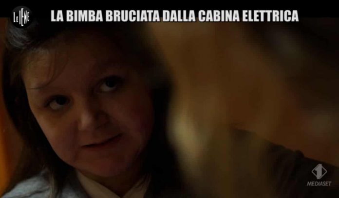 Le Iene, Palmieri: “Vicky, la bambina bruciata dalla cabina elettrica” | video Foto bambina bruciata Iene 2019