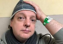 Dado aggredito dall’ex fidanzato della figlia: “Facciamo qualcosa contro i bulli” Il comico dado aggredito. La foto postata