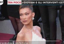 Mattino Cinque, vip e chirurgia estetica: da Taylor Mega a Bella Hadid | Video Mediaset Mattino Cinque, vip e chirurgia