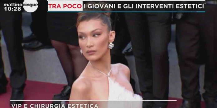 Mattino Cinque, vip e chirurgia estetica: da Taylor Mega a Bella Hadid | Video Mediaset Mattino Cinque, vip e chirurgia