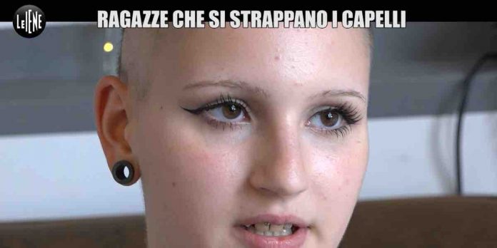 Le Iene, tricotilloma, il disturbo che spinge le ragazze a strapparsi i capelli | Video Mediaset Le Iene tricotilloma e i ragazzi che si strappano i capelli