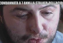 Le Iene, il caso di Giuseppe Morgante sfregiato con l’acido dalla ex Sara | Video Mediaset Le Iene stalker acido