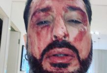 Il caso Fabrizio Corona a Live Non è la D’Urso: “ha una patologia psichiatrica” | Video Mediaset Fabrizio Corona