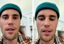 Justin Bieber, la malattia di Lyme e la sindrome di Ramsay Hunt: «Ho metà volto paralizzato». Ecco cos’è | Video Justin Bieber