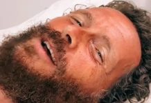 Jovanotti cade dalla bici: femore e clavicola rotti – VIDEO jovanotti ospedale