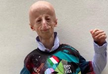 Chi era Sammy Basso, morto all’età di 28 anni? La sua storia e la sua malattia sammy_basso